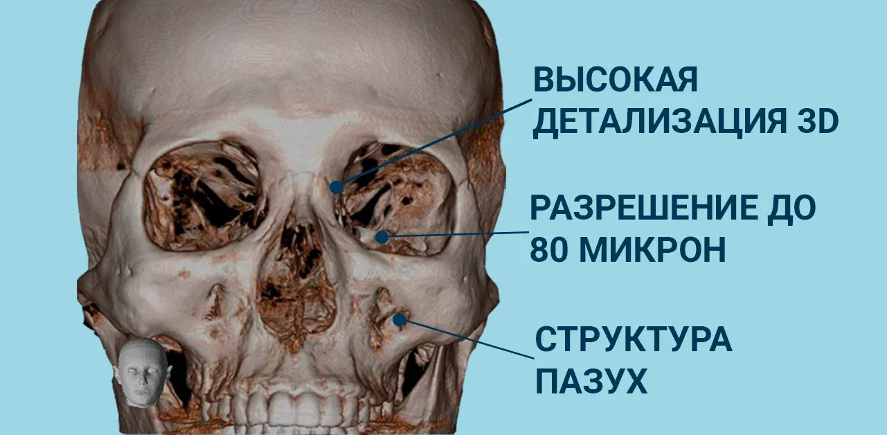 3D Компьютерная томография носа